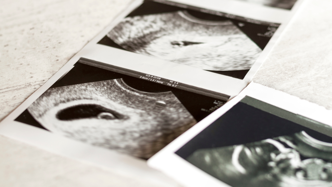 10 weeks pregnant, 30 to go: Pregnancy insights that you should know
